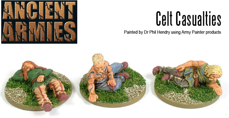 WLG WG-CE-CAS-2ITEM IMAGE 1